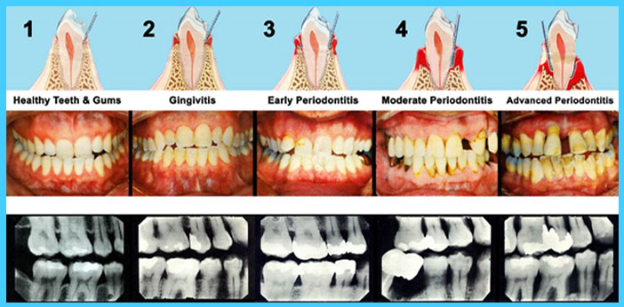 Dentist Vancouver